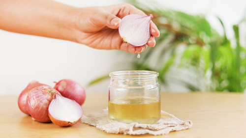 Lợi ích sức khỏe của hành tây