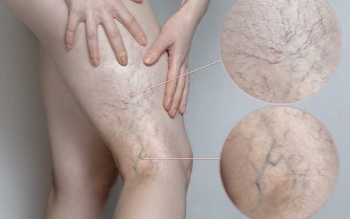 Căn bệnh cực kỳ nguy hiểm