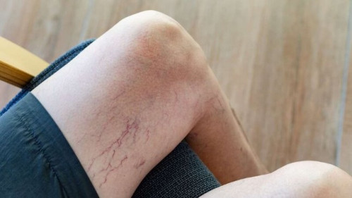 Căn bệnh cực kỳ nguy hiểm