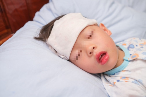 Trẻ em không nên tiêm vắc xin sống khi mắc các vấn đề sức khỏe