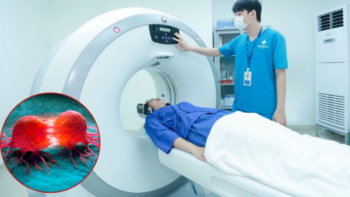 Chụp CT ảnh hưởng đến sức khỏe