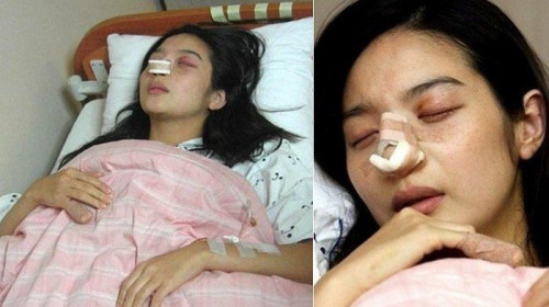 Diễn viên bị bạo hành nghiêm trọng