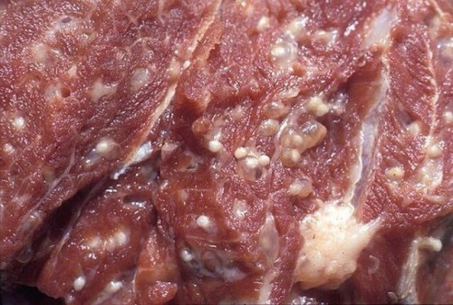 Dấu hiệu nhiễm sán trong thực phẩm
