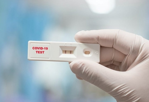 Dịch COVID-19 tái bùng phát