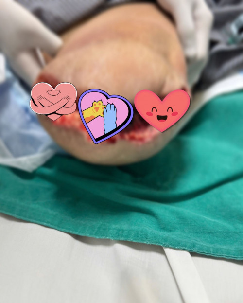 Giành giật sự sống từ bệnh nhân