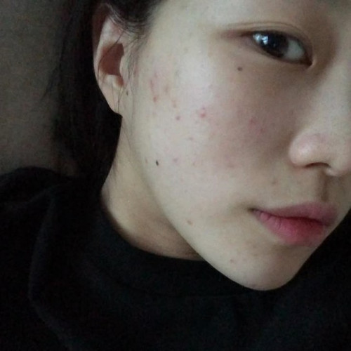 Dấu hiệu độc tố
