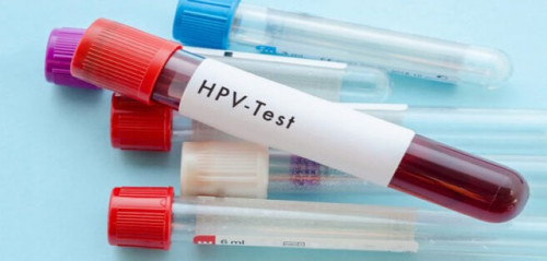 Vắc xin HPV giúp phòng các bệnh ung thư nào?