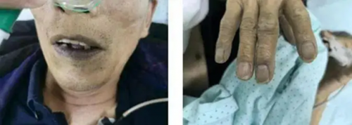 Nam thanh niên 25 tuổi tiêu ra "nước xanh kỳ quái"