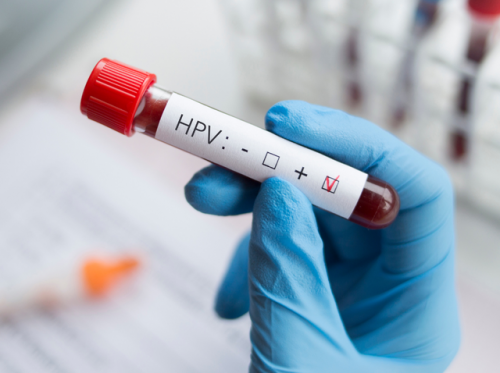Người từng nhiễm virus HPV có cần tiêm vắc xin HPV nữa hay không?- Ảnh 1.