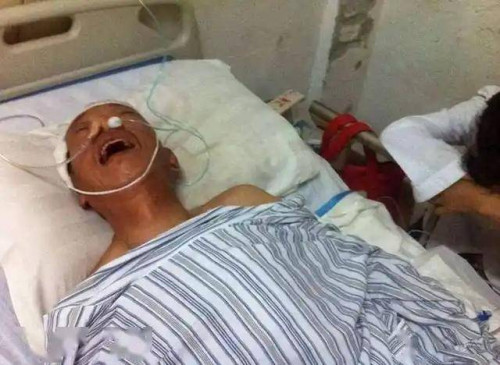 Tình trạng nhồi máu não ngày càng gia tăng.