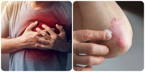 8 dấu hiệu cảnh báo thận không khỏe- Ảnh 1.