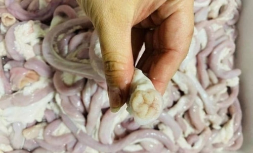 Người phụ nữ bán lòng lợn nhiễm liên cầu khuẩn- Ảnh 1.