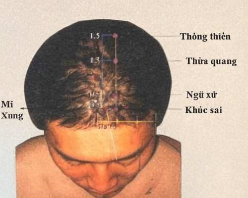 Huyết Thủ Quang