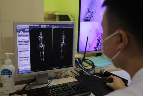 Máy xạ trị chạy 23 tiếng mỗi ngày vì quá tải bệnh nhân ung thư.