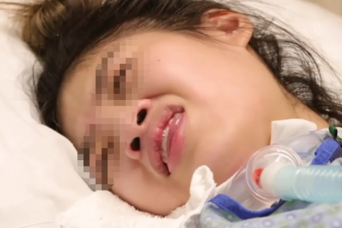 Phản ứng nghiêm trọng sau khi tiêm vắc xin HPV