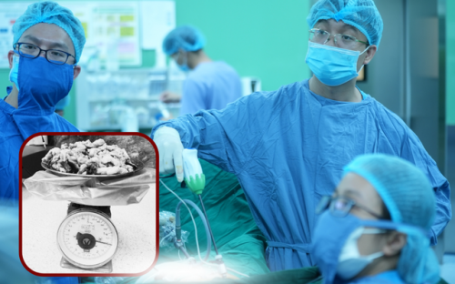 Người phụ nữ hơn 1 thập kỷ 'sống chung' với u xơ tử cung nặng gần 1.5kg- Ảnh 1.