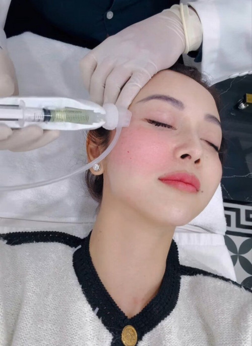 Tiêm tế bào gốc cho da