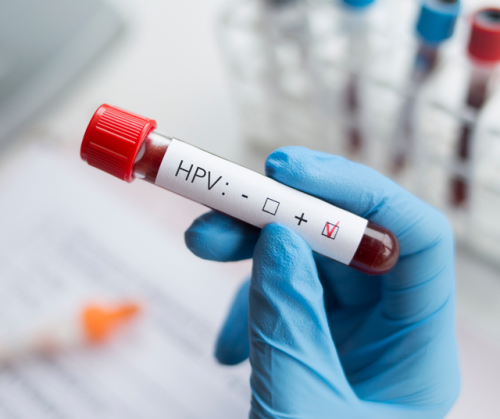 Khả năng nhiễm lại virus HPV