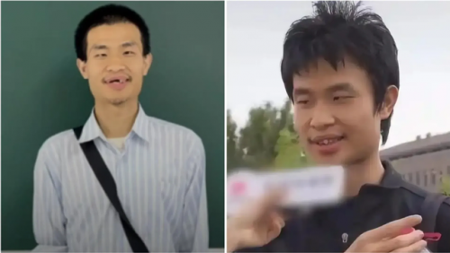 Viêm nha chu và sức khỏe tổng thể