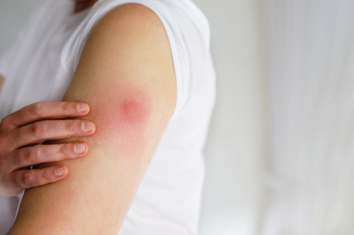7 việc nữ giới nhất định KHÔNG ĐƯỢC LÀM ngay sau khi vừa tiêm vắc xin HPV- Ảnh 1.