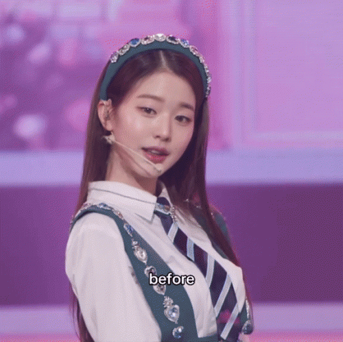 "Công chúa" Jang Won Young bơm môi đến không thể cười nổi?- Ảnh 5.