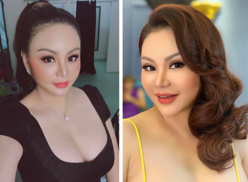 Hình ảnh Lê Giang sau phẫu thuật