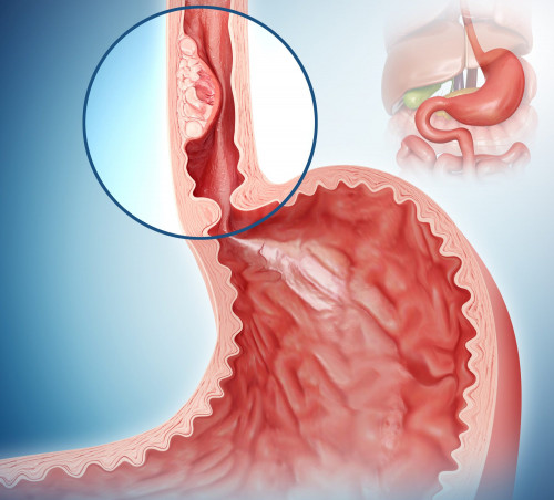 Thói quen ăn uống ảnh hưởng tới tế bào