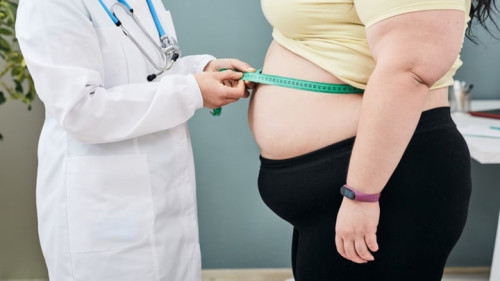 Tăng 35 kg trong một năm do 'ăn để xả stress'