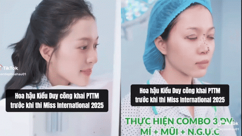 Kiều Duy thực hiện phẫu thuật thẩm mỹ