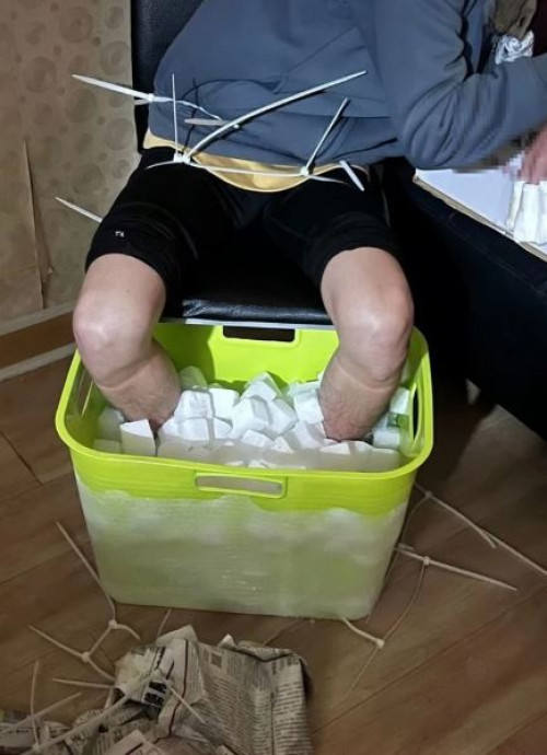 Nam sinh viên phải cắt cụt chân sau 10 tiếng ngâm đá khô - Ảnh 1.