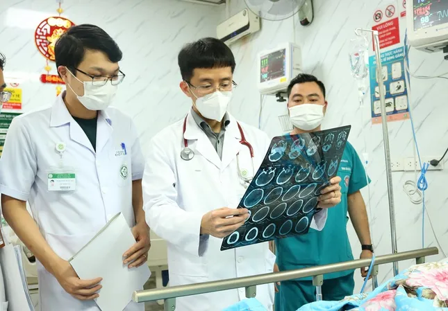25% người bị đột quỵ tái phát, bác sĩ chỉ cách ngăn ngừa để... 'giữ mạng'- Ảnh 3.