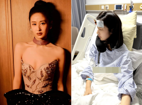 Một nữ diễn viên hạng A phải cắt bỏ túi mật