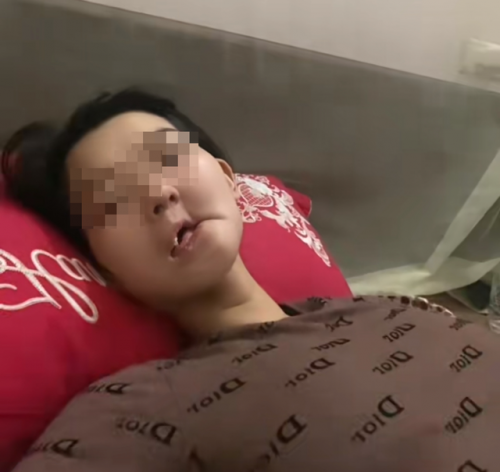 Hình ảnh cô gái mắc ung thư xương hàm, bữa ăn hàng ngày là "cháo xay loãng ăn bằng xi lanh" gây xót xa.