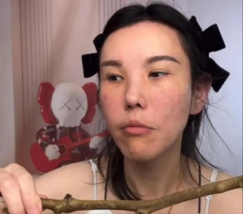 Mặt nữ mukbang biến dạng nghiêm trọng sau 2 năm hành nghề- Ảnh 2.