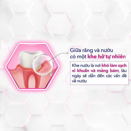 Chăm sóc nướu đúng cách - Ảnh 1