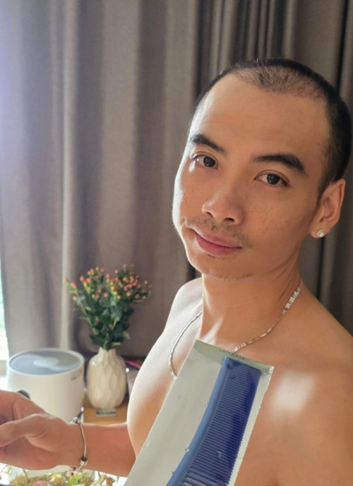 Chồng H'Hen Niê thay đổi thế nào sau cây tóc trị hói đầu? Phương pháp này có giá bao nhiêu?- Ảnh 1.