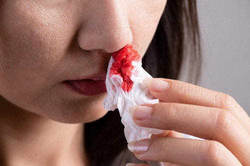 Bác sĩ cảnh báo: Cẩn trọng với những vết bầm là trên da!