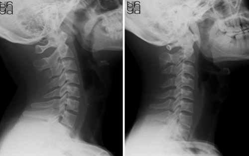 Người trẻ 20 tuổi mà xương khớp như 'người già': Bác sĩ nói đã số đều có 4 đặc điểm, sửa ngay còn kịp- Ảnh 1.