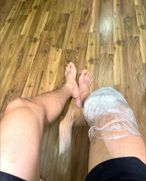 Bình An bị chấn thương khi chơi bóng đá