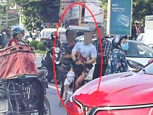 Tiktoker bị chém gần đứt lìa bàn tay giữa phố Thái Nguyên.