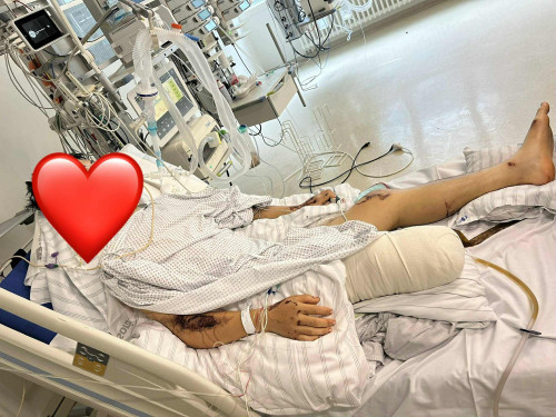 Du học sinh Việt gặp tai nạn nghiêm trọng tại Đức, người thân chia sẻ tình hình sau ca mổ não.