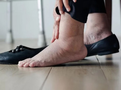 7 dấu hiệu vào buổi tối cảnh báo tắc mạch thận ở nam giới: Nếu có hãy đi khám ngay- Ảnh 2.